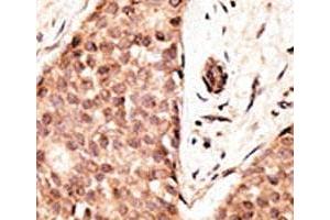 Immunohistochemistry (IHC) image for anti-Caudal Type Homeobox 2 (CDX2) (AA 1-30) antibody (ABIN3030336)