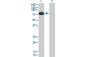 Western Blot analysis of PLXDC1 expression in transfected 293T cell line by PLXDC1 monoclonal antibody (M01), clone 4B10. (PLXDC1 抗体  (AA 313-421))