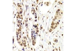 Immunohistochemistry (Paraffin-embedded Sections) (IHC (p)) image for anti-Nuclear Autoantigenic Sperm Protein (Histone-Binding) (NASP) (AA 180-449) antibody (ABIN6144374)