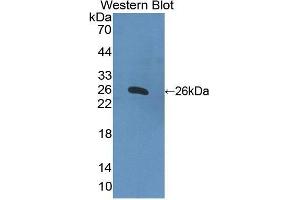 Western Blotting (WB) image for anti-Apolipoprotein B (APOB) antibody (FITC) (ABIN1862186) (APOB 抗体  (FITC))