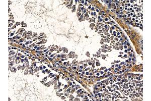 ABIN6258208 and ABIN6273864 at 1/100 staining rat testis tissue by IHC-P. (GPR26 抗体  (C-Term))