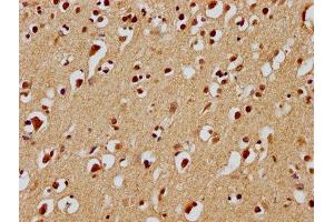 IHC image of ABIN7139932 diluted at 1:100 and staining in paraffin-embedded human brain tissue performed on a Leica BondTM system. (UBE2M 抗体  (AA 11-28))