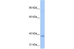 NSUN3 antibody used at 0. (NSUN3 抗体  (C-Term))