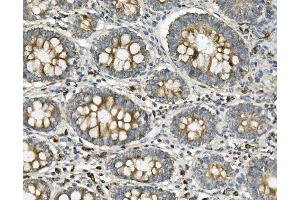 IHC analysis of ME2 using anti-ME2 antibody (ABIN7600967).