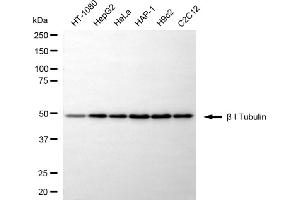 anti-Tubulin, beta 1 (TUBB1) antibody