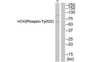 Western blot analysis of extracts from JurKat cells using HCK (Phospho-Tyr522) Antibody. (HCK 抗体  (pTyr521))