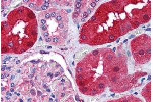 Human Kidney (formalin-fixed, paraffin-embedded) stained with RNF213 antibody ABIN290404 at 1. (RNF213 抗体  (AA 5191-5204))
