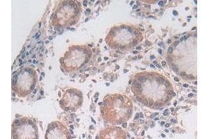 Immunohistochemistry (IHC) image for anti-Utrophin (UTRN) (AA 1-252) antibody (ABIN7443953)