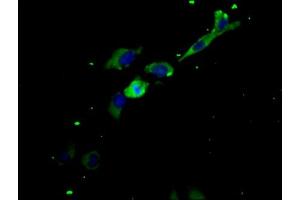 Immunofluorescence staining of Hela cells with ABIN7158226 at 1:200, counter-stained with DAPI. (LIFR 抗体  (AA 915-1086))