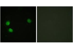 Immunofluorescence analysis of HeLa cells, using Bloom Syndrome (Phospho-Thr99) Antibody. (Bloom Syndrome (AA 65-114), (pThr99) 抗体)
