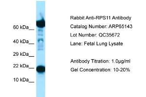 Western Blotting (WB) image for anti-Ribosomal Protein S11 (RPS11) (C-Term) antibody (ABIN2790056) (RPS11 抗体  (C-Term))