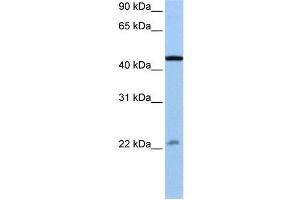 WB Suggested Anti-EWSR1  Antibody Titration: 0. (EWSR1 抗体  (N-Term))