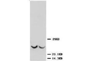 Western blot analysis of rat kidney tissue lysis using TIMP3 antibody (TIMP3 抗体  (C-Term))