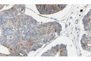 ABIN6276417 at 1/100 staining Human prostate tissue by IHC-P. (JUP 抗体  (C-Term))