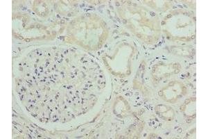 Immunohistochemistry of paraffin-embedded human kidney tissue using ABIN7171040 at dilution of 1:100 (SUSD6 (AA 144-303) 抗体)