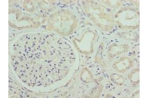 Immunohistochemistry of paraffin-embedded human kidney tissue using ABIN7171040 at dilution of 1:100 (SUSD6 (AA 144-303) 抗体)