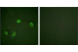 Immunofluorescence analysis of HeLa cells, using C-RAF (Phospho-Ser621) Antibody. (RAF1 抗体  (pTyr621))