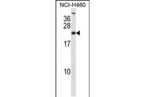 Western blot analysis in NCI-H460 cell line lysates (35ug/lane). (RPS16 抗体  (AA 45-74))