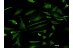 Immunofluorescence (IF) image for anti-Zinc Finger Protein 274 (ZNF274) (AA 420-530) antibody (ABIN524204)