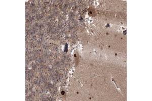 Immunohistochemical staining of human cerebellum with COPS4 polyclonal antibody  shows strong nuclear and cytoplasmic positivity in Purkinje cells at 1:20-1:50 dilution. (COPS4 抗体)