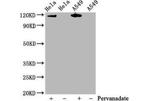 Western Blot Positive WB detected in Hela whole cell lysate,A549 whole cell lysate(treated with Pervanadate or not) All lanes Phospho-JAK2 antibody at 0. (Recombinant JAK2 抗体  (pTyr1007, pTyr1008))