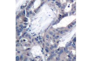 Immunohistochemistry (IHC) image for anti-Mitogen-Activated Protein Kinase Kinase 2 (MAP2K2) (pThr394) antibody (ABIN3019566) (MEK2 抗体  (pThr394))