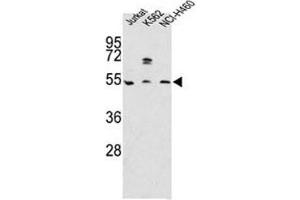 Western blot analysis of APOA4 antibody and Jurkat, K562, NCI-H460 lysate (APOA4 抗体  (AA 49-79))
