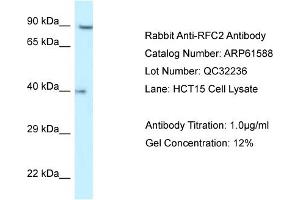 Western Blotting (WB) image for anti-Replication Factor C (Activator 1) 2, 40kDa (RFC2) (N-Term) antibody (ABIN2788844) (RFC2 抗体  (N-Term))