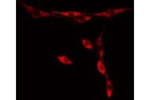 ABIN6276439 staining  HuvEc cells by IF/ICC. (PARK7/DJ1 抗体  (C-Term))