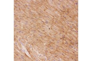 Immunohistochemistry (IHC) image for anti-Solute Carrier Family 2 (Facilitated Glucose Transporter), Member 4 (SLC2A4) (AA 333-509) antibody (ABIN3043929)