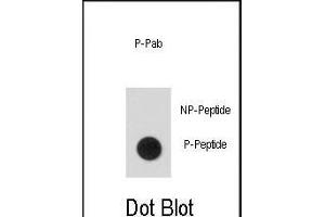 Dot blot analysis of anti-Phospho-hSTAT5a-p Phospho-specific Antibody (ABIN389667 and ABIN2839646) on nitrocellulose membrane. (STAT5A 抗体  (pSer726))