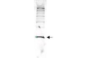 Image no. 1 for anti-Parkinson Protein 7 (PARK7) (AA 177-189) antibody (ABIN401278) (PARK7/DJ1 抗体  (AA 177-189))