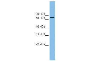 ODF2 antibody used at 1 ug/ml to detect target protein. (ODF2 抗体  (N-Term))