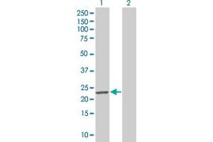 Western Blot analysis of MND1 expression in transfected 293T cell line by MND1 MaxPab polyclonal antibody. (MND1 抗体  (AA 1-205))