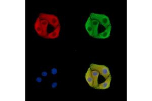 ABIN7095715 and ABIN7099777 staining Hela cells by IF/ICC. (SLC25A29 抗体)