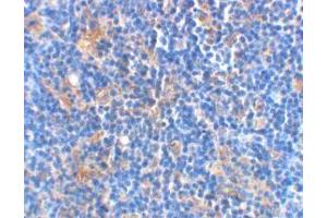 Immunohistochemistry (Paraffin-embedded Sections) (IHC (p)) image for anti-BCL2-Associated Agonist of Cell Death (BAD) antibody (ABIN499399)