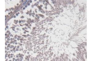 Immunohistochemistry (IHC) image for anti-Cytochrome P450, Family 17, Subfamily A, Polypeptide 1 (CYP17A1) (AA 201-507) antibody (ABIN7444547)