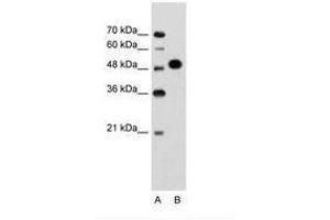 Image no. 1 for anti-Makorin Ring Finger Protein 1 (MKRN1) (AA 101-150) antibody (ABIN203479) (MKRN1 抗体  (AA 101-150))