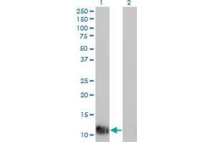 Western Blot analysis of FABP1 expression in transfected 293T cell line by FABP1 monoclonal antibody (M01), clone 4G5. (FABP1 抗体  (AA 1-127))
