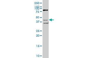 SCAP2 polyclonal antibody (A01), Lot # 050921JC01. (SKAP2 抗体  (AA 1-359))