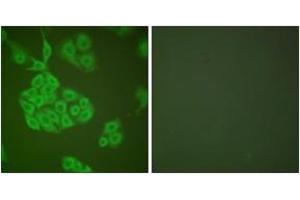 Immunofluorescence analysis of A549 cells, using MMP-11 Antibody. (MMP11 抗体  (AA 61-110))