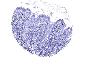 Colon descendes mucosa In the normal colon MPO positive granulocytes occur within small capillaries and also the stroma of the lamina propria (Myeloperoxidase 抗体)