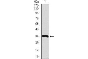 Western blot analysis using LPA antibody against human LPA recombinant protein. (Lp(a) 抗体  (AA 4330-4521))