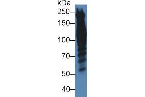 Western blot analysis of Human HeLa cell lysate, using Human PPL Antibody (5 µg/ml) and HRP-conjugated Goat Anti-Rabbit antibody ( (PPL 抗体  (AA 1439-1716))