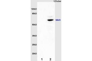 L1 mouse kidney lysates L2 mouse brain lysates probed with Anti ER-beta Polyclonal Antibody, Unconjugated (ABIN725210) at 1:200 overnight at 4 °C. (ESR2 抗体  (AA 201-300))