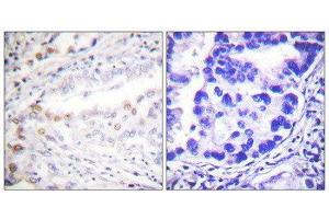 Immunohistochemistry (IHC) image for anti-SUMO1 Activating Enzyme Subunit 2 (UBA2) (C-Term) antibody (ABIN1848873) (UBA2 抗体  (C-Term))