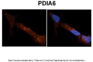 Sample Type: NT2 cells Red: Antibody Blue: DAPI Primary Dilution: 1ug/50ul antibody Secondary Antibody: Alexa goat anti-rabbit 594 Image Submitted by: Yuzhi Chen, University of Arkansas for Medical Sciences (PDIA6 抗体  (N-Term))