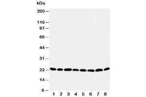 Western blot testing of Peroxiredoxin 5 antibody and Lane 1:  rat brain (Peroxiredoxin 5 抗体  (C-Term))