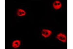 ABIN6277682 staining HepG2 by IF/ICC. (PIAS2 抗体  (N-Term))