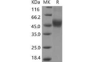 Interleukin 2 Receptor, beta (IL2RB) protein (His tag)